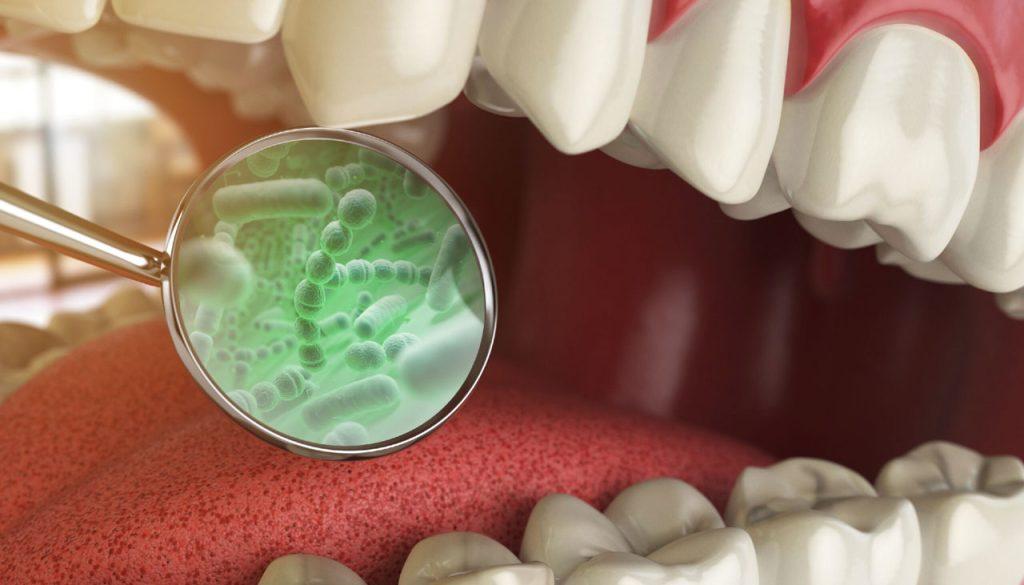L'alito cattivo puoi essere causato dai batteri presenti all'nterno della bocca