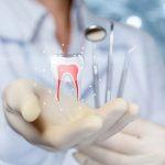 La devitalizzazione dentaria